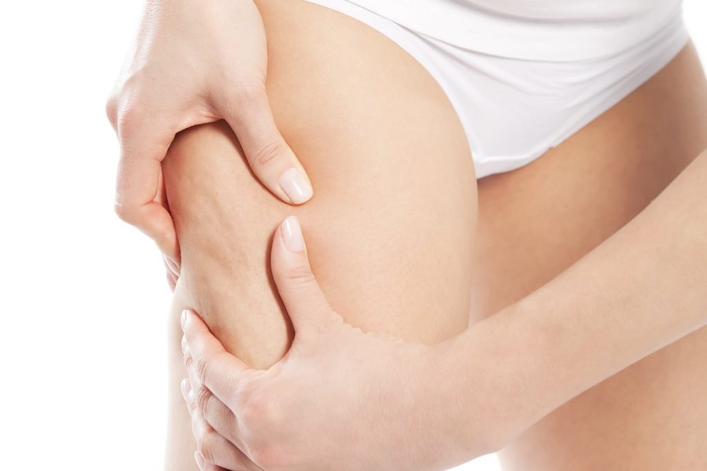  laser de CO2 para flacidez