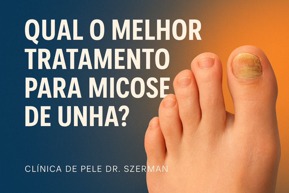 micose de unha