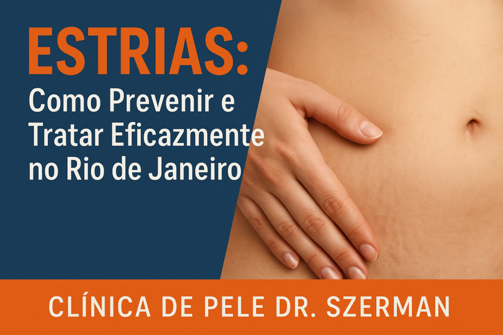 estrias
