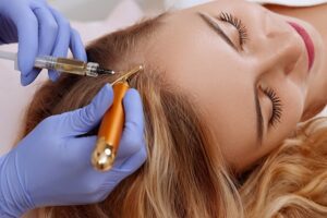 MMP Capilar, queda de cabelo, crescimento capilar, fortalecimento dos fios, tratamento inovador, densidade capilar, saúde capilar, estimulação capilar, terapia capilar, revitalização dos cabelos.