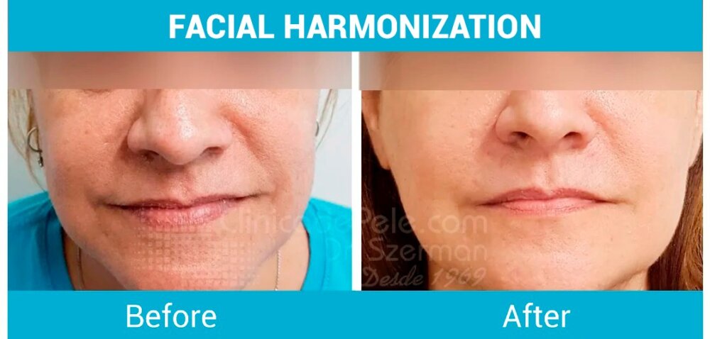 PHOTO 2025 08 01 18 01 17 1