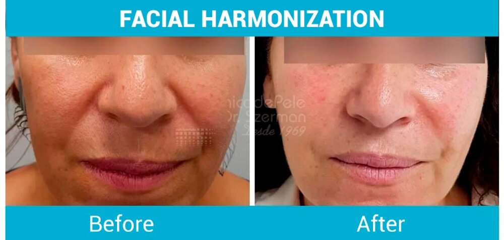 PHOTO 2025 08 01 18 01 17