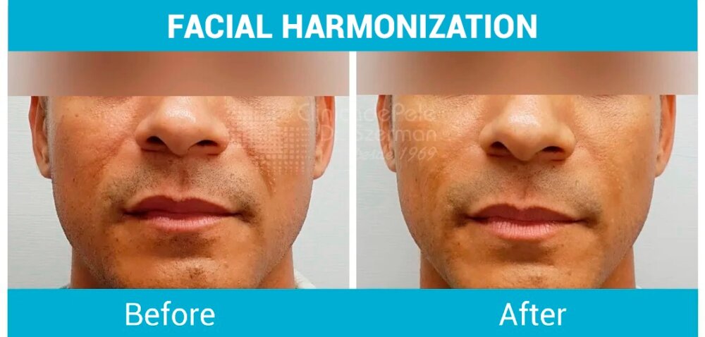 PHOTO 2025 08 01 18 01 18