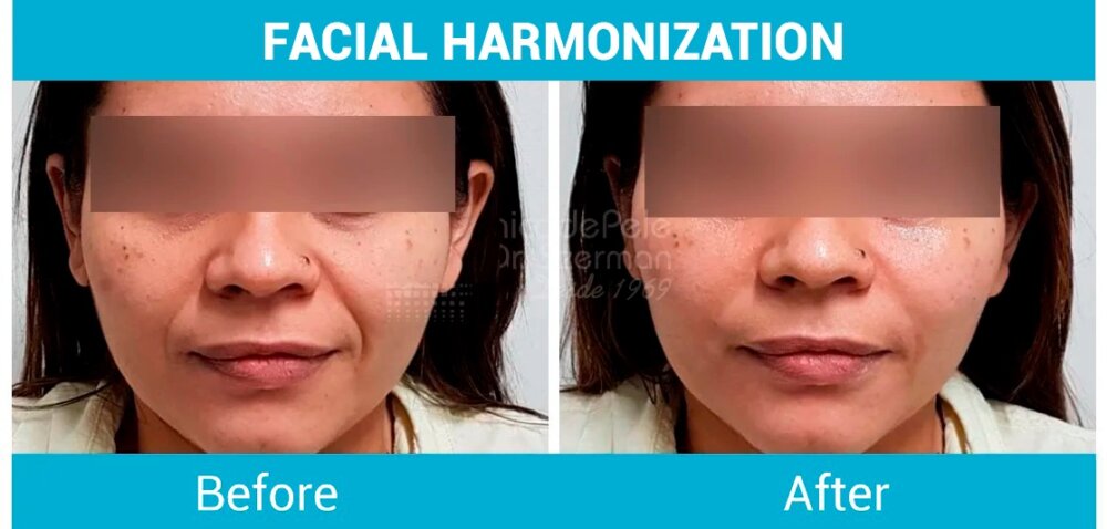 PHOTO 2025 08 01 18 01 19