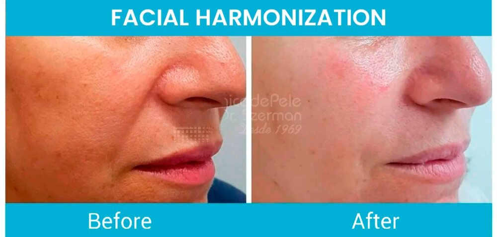 PHOTO 2025 08 01 18 01 35