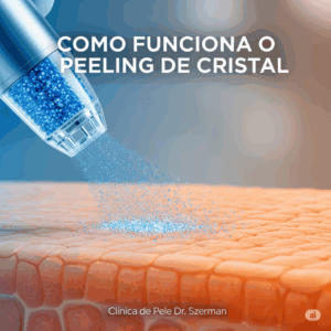 como funciona o peeling de cristal