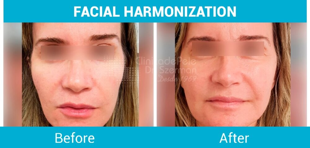 PHOTO 2025 08 01 18 01 16 1