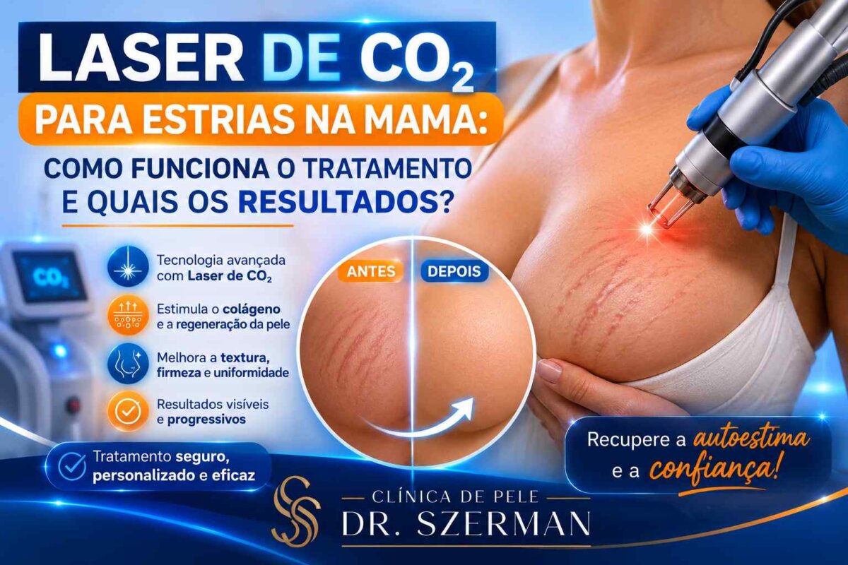 laser de co2 para estrias nas mamas