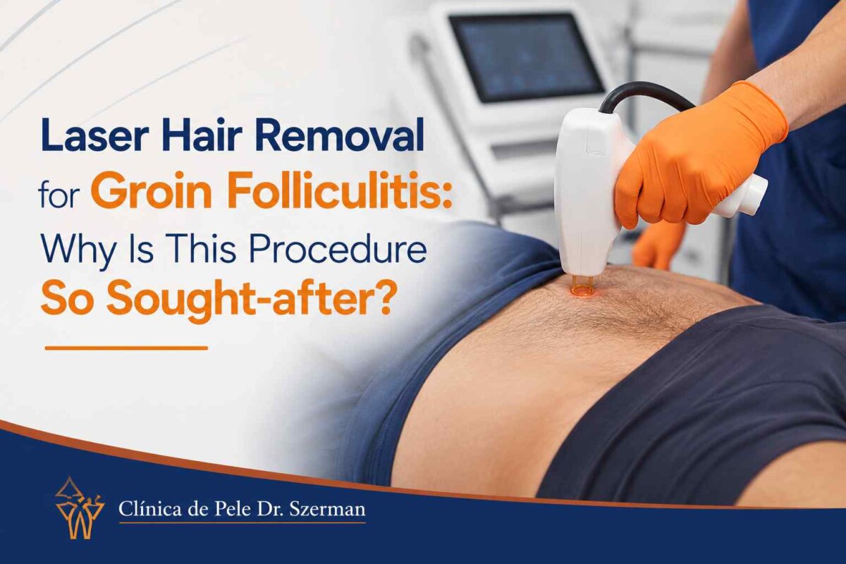 Laser Hair Removal for Groin Folliculitis